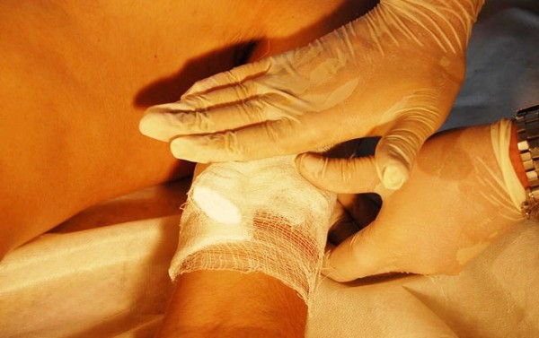 
        Первая помощь при острой кровопотере и травматическом шоке			    