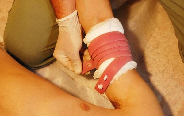 
        Первая помощь при острой кровопотере и травматическом шоке			    