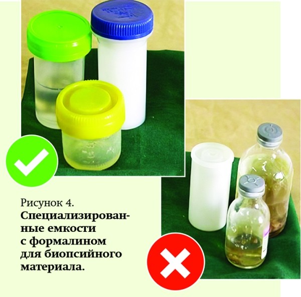 
        Патогистологическое сопровождение при диагностике заболеваний			    