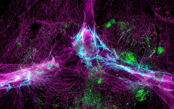 
        Ученые обнаружили,  что мозг не особая закрытая зона			    
