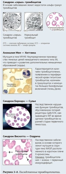 Тромбоцитоз и тромбоцитопения: диагностический поиск
Тромбоцитоз и тромбоцитопения: диагностический поиск